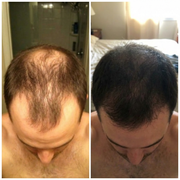 Real hair transformation 1