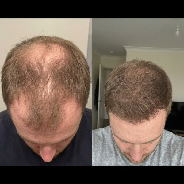 Real hair transformation 5