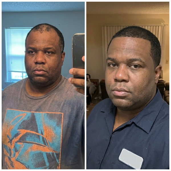 Real hair transformation 2