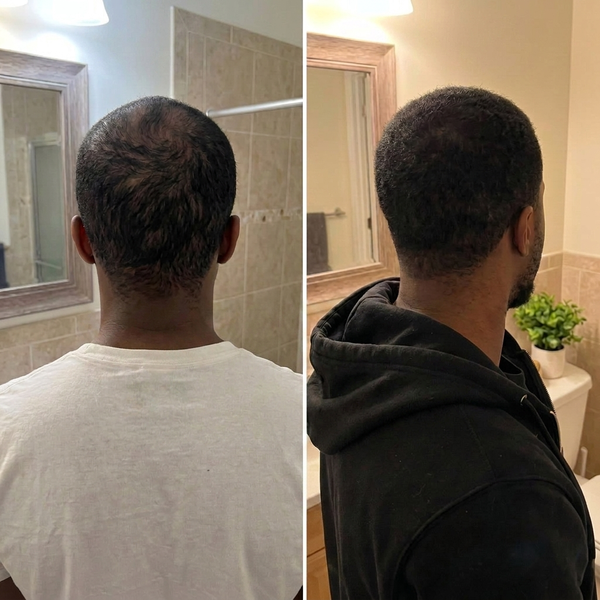 Real hair transformation 6